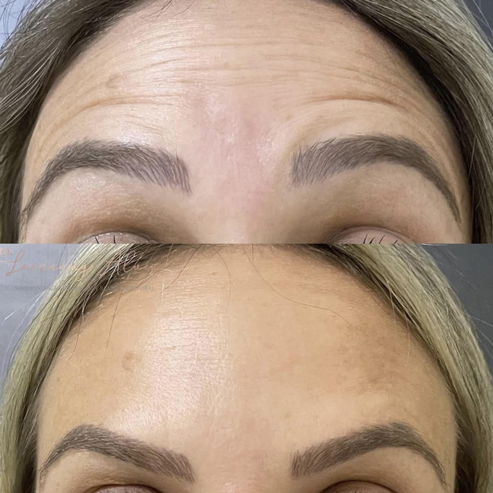 dra-yasmin-img-resultados-006