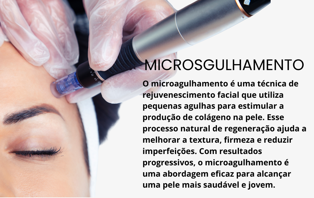 Microagulhamento