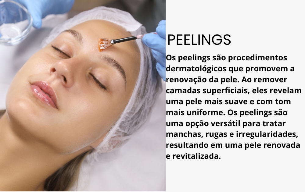 Peelings